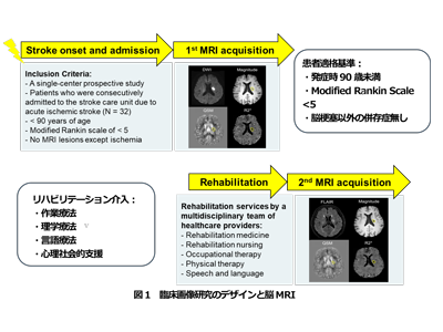 脳梗塞後のリハビリ、神経学的予後と関連する画像評価法確立－名古屋市大ほか