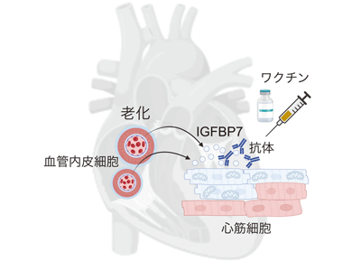 心不全ワクチンの技術開発に成功、標的は「IGFBP7」－東大病院ほか