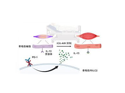 敗血症患者のICU関連筋力低下、PD-1阻害剤が新たな治療薬候補に－三重大