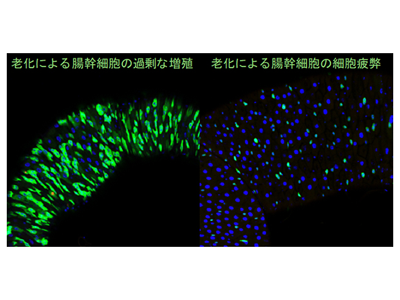 老化による幹細胞の疲弊、関連する染色体と遺伝子発現の変化をハエで発見－理研