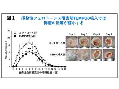 褥瘡にフェロトーシスが関与、阻害剤「吸入」でマウスの潰瘍縮小－群大ほか