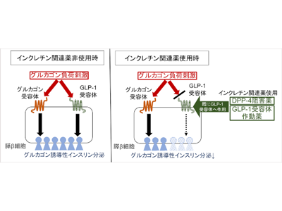 糖尿病、インクレチン関連薬使用中はグルカゴン応答性インスリン分泌低下－岐阜大ほか