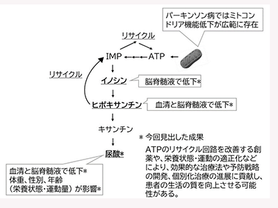 パーキンソン病、血清・脳脊髄液中尿酸レベル低下＋プリン代謝異常を発見－藤田医科大