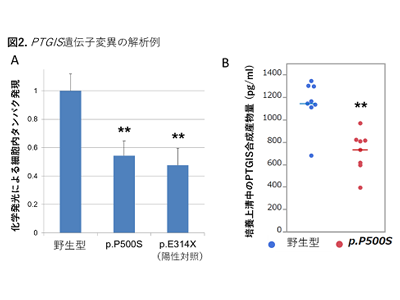 もやもや症候群、発症にかかわる遺伝学的なメカニズムの一端を解明－女子医大ほか