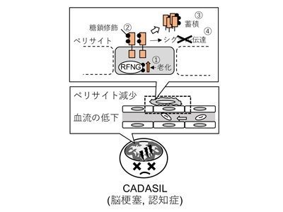 CADASIL、変異タンパク質の糖鎖修飾による蓄積機構を解明－千葉大ほか