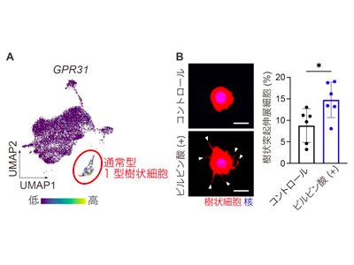 ヒト腸管樹状細胞が樹状突起を伸展させ、異物を感知していることを発見－阪大ほか