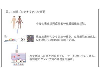 重症薬疹のTEN、空間プロテオミクス解析でJAK阻害剤が有効と判明－新潟大ほか