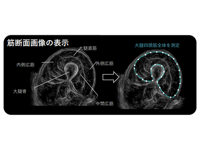 モバイル筋肉専用超音波測定装置を開発、CTのように広範囲描出可能－長寿研ほか