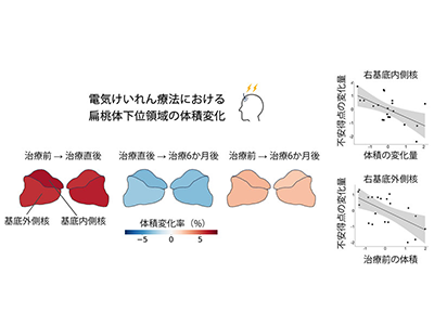 電気けいれん療法後の扁桃体下位領域構造変化が、症状改善と関連の可能性－京大