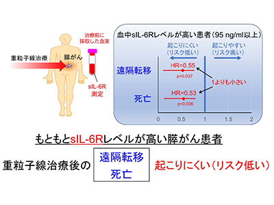 膵臓がん重粒子線治療、予後予測血中バイオマーカーとしてsIL-6Rを同定－量研