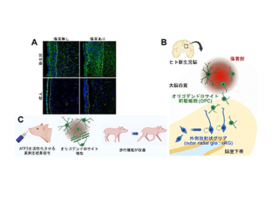 新生児脳障害、ヒト特有の神経再生メカニズムを解明－名古屋市大ほか