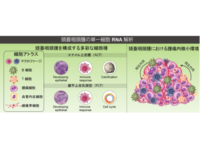 頭蓋咽頭腫、治療法開発につながる腫瘍微小環境の分子機序を解明－千葉大ほか