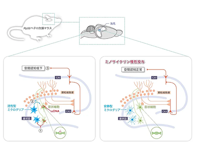 加齢による認知機能低下、ミノサイクリンで予防の可能性－都医学研ほか