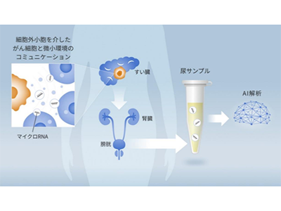 早期膵臓がん、尿中マイクロRNAによる非侵襲的検査を開発－慶大ほか