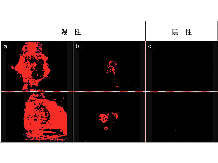 肉眼では見えない便潜血の画像化に成功、トイレで測定できる機器開発へ－国がんほか