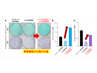 軟骨無形成症、CDK8阻害剤投与で疾患マウスの長管骨伸長－岐阜薬科大ほか