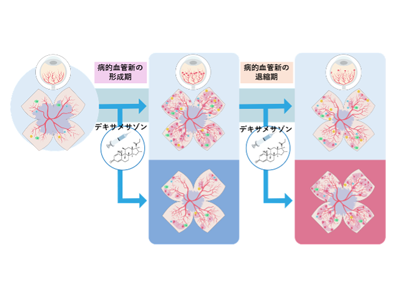 網膜疾患のステロイド治療、投与時期により血管修復メカニズム損なう可能性－京大ほか