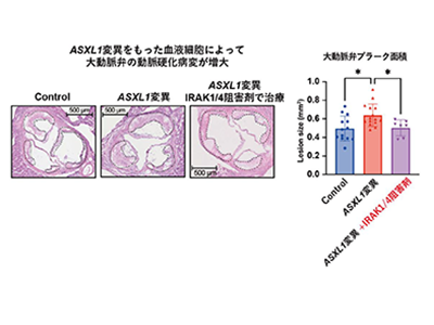 白血病関連遺伝子ASXL1変異の血液による、動脈硬化誘導メカニズム解明－東大