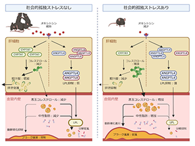 「社会的孤独」による動脈硬化と脂質代謝異常、オキシトシンで抑制の可能性－慶大ほか