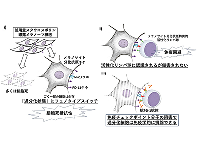 過分化メラノーマモデルを樹立、免疫学的特徴を解明－埼玉医大