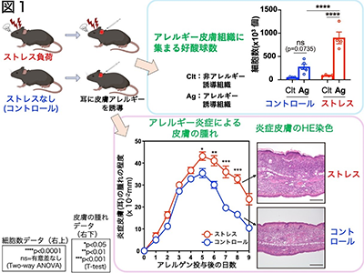 アトピー性皮膚炎、精神的ストレスで悪化のメカニズムを解明－順大ほか