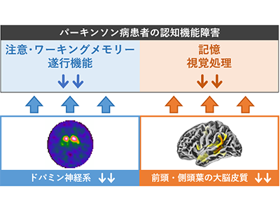 パーキンソン病の認知機能低下、複数の神経基盤を解明－京大