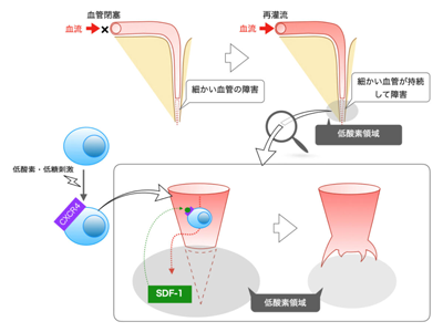 脳梗塞の新しい細胞療法を開発、単核球による低酸素状態の改善－新潟大ほか