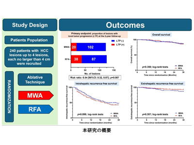 肝細胞がんのマイクロ波焼灼、従来法と比較した有用性をRCTで証明－東京医科大ほか