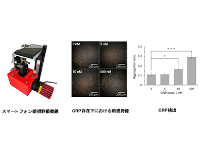 炎症性バイオマーカーCRP、簡易検出手法を開発－愛媛大