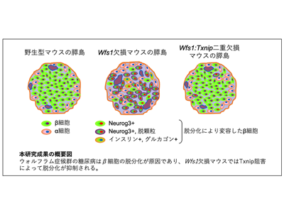 ウォルフラム症候群の治療標的候補を発見、β細胞の脱分化を制御－山口大